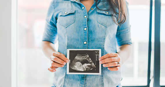 A woman holds a sonogram in front of her signifying she is newly pregnant and will need to change her benefits